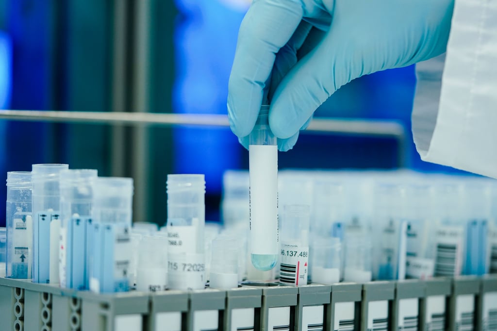 Ein Mitarbeiter hält in einem Coronatest-Labor PCR-Teströhrchen in den Händen.