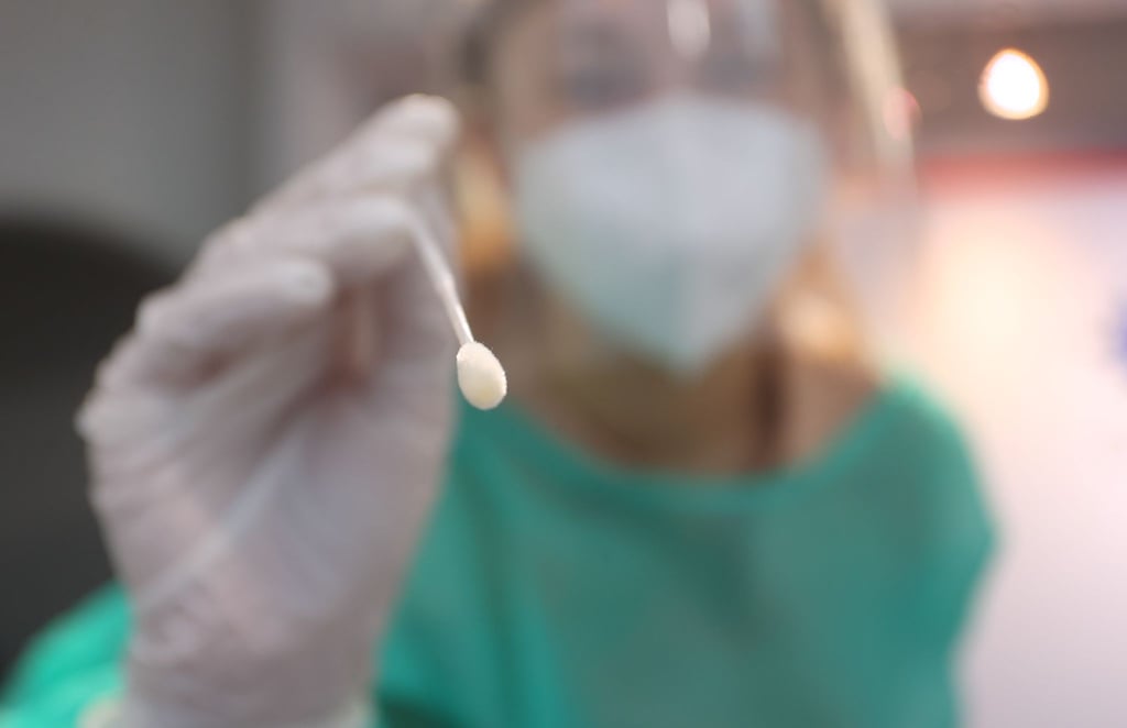 Weil die Kapazitäten nicht reichen, soll es bei den PCR-Testungen nun eine Priorisierung für bestimmte Personengruppen geben. Aber viele Details dazu sind bisher ungeklärt.