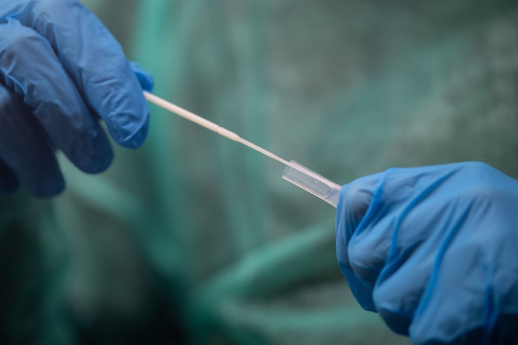 Bei Corona-Tests am Uniklinikum Magdeburg ist es zu einer Info-Panne gekommen. Etwa 100 Magdeburger sind betroffen.