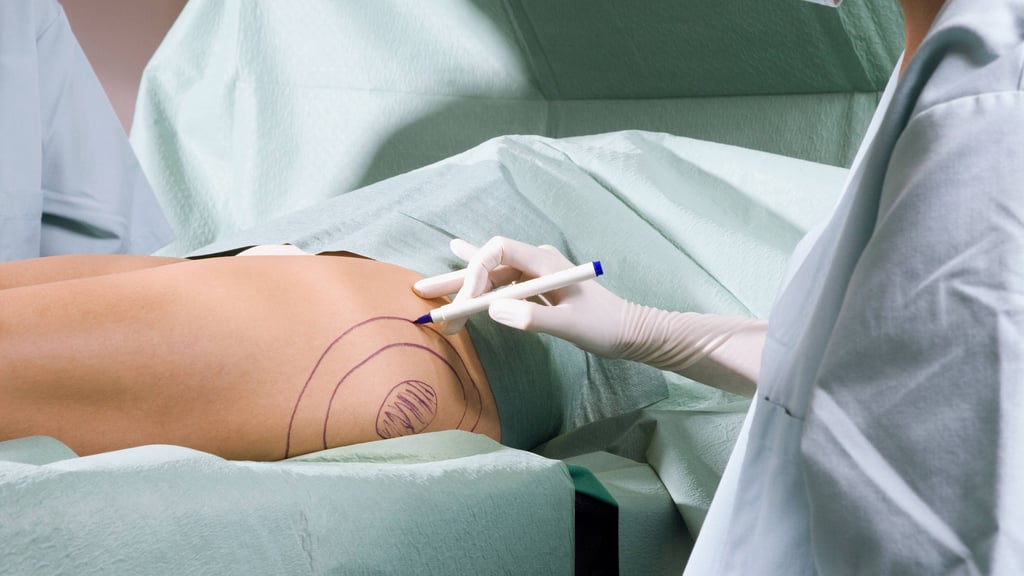 Prominente sind für eine Sucht nach Operationen besonders anfällig, da sie unter großem öffentlichen Druck stehen.