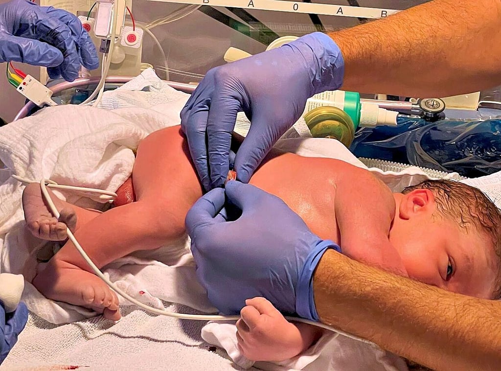 Ein Säugling wird kurz nach der Geburt in der Neonatologie des Harzklinikums in Wernigerode untersucht. Die Intensivstation für Früh- und Neugeborene befindet sich Wand an Wand mit den Kreißsälen.
