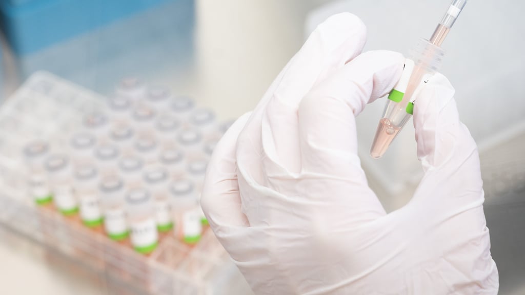 Eine biologisch-technische Assistentin bereitet PCR-Tests auf das Coronavirus für die Analyse vor. Foto: Julian Stratenschulte/
