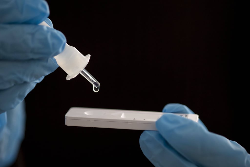 396 neue Infektionen mit dem Coronavirus sind am Mittwoch bekannt geworden, 27 weniger als vor einer Woche.