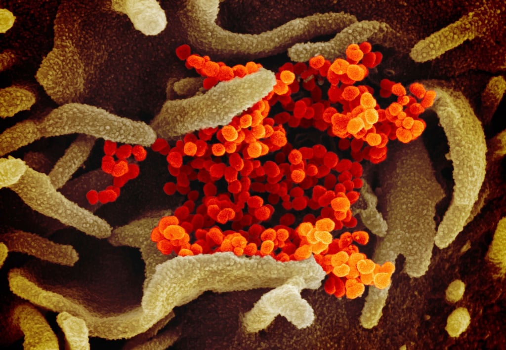 Das Coronavirus (SARS-CoV-2) (orange), das aus der Oberfläche von im Labor kultivierten Zellen (grau) austritt. Die Probe wurde von einem Patienten in den USA isoliert.