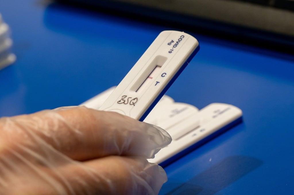 Auch über den Sommer soll es weiter ein Angebot mit kostenlosen Corona-Schnelltests für Risikogruppen geben - für alle anderen sollen Bürgertests aber künftig drei Euro kosten.