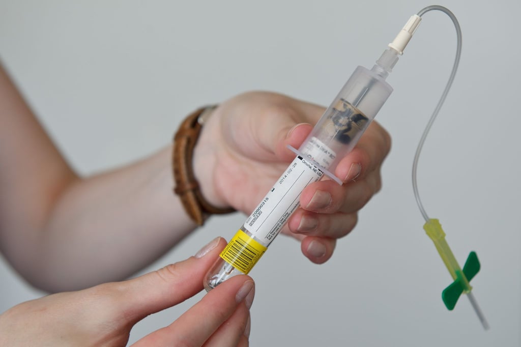 Bluttests, die Kenntnis über gewisse Erbgutfehler beim Baby versprechen, werden ab dem 1. Juli in bestimmten Fällen von den Kassen bezahlt.