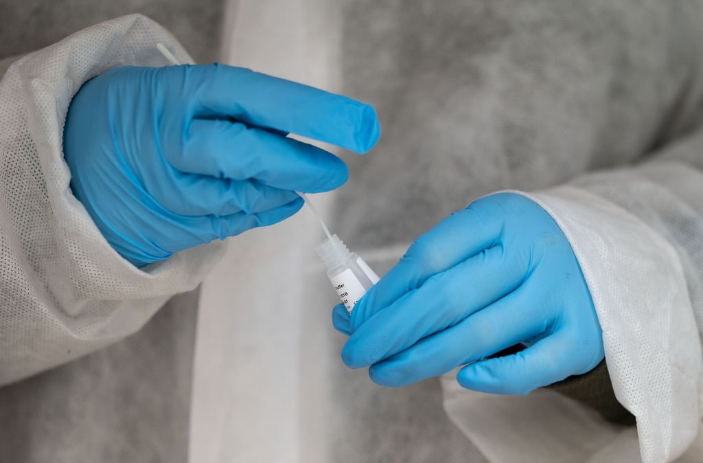 Wie steht es um die Covid-Infektionslage in Deutschland?