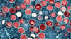 Partikel des Affenpockenvirus (rot) in einer infizierten Zelle (blau). Die Affenpocken-Fälle in Europa steigen an.