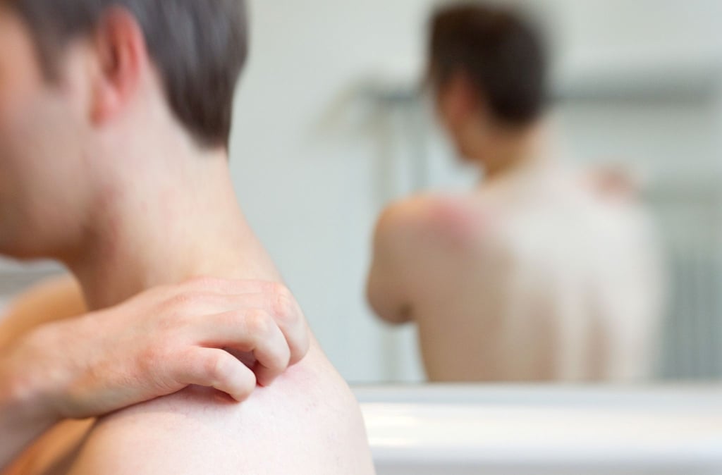 Hautbläschen und Juckreiz sind typische Symptome der Gürtelrose. Die Erkrankung kann aber auch chronische Nervenschmerzen verursachen.