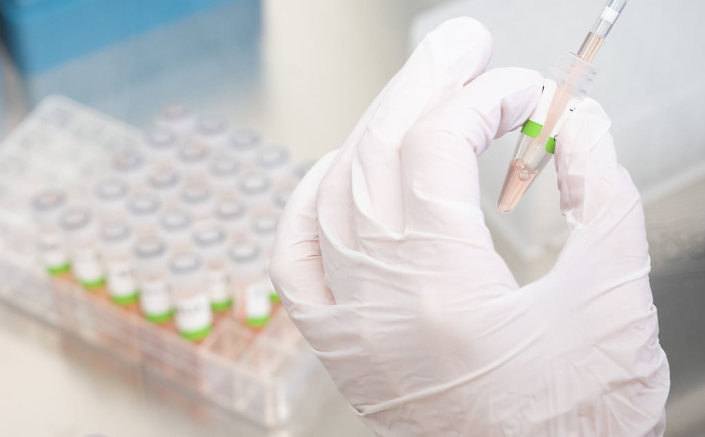 Eine biologisch-technische Assistentin bereitet PCR-Tests für die Analyse vor.