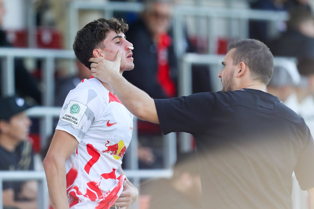 Ging hart zur Sache beim Duell der Junioren von RB und Celtic: Jordan Winter mit Nasenbluten