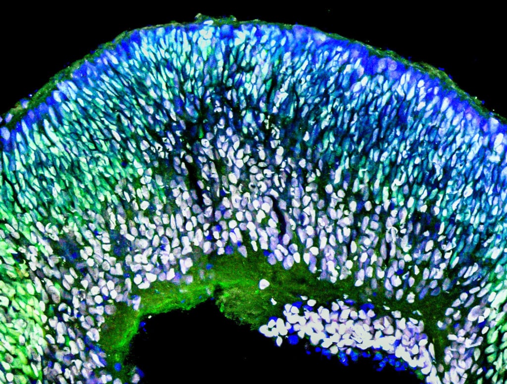 Undatiertes Foto zeigt ein Organoid der Retina (Netzhaut) am 50.
