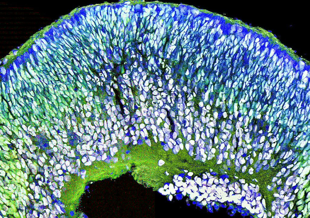 Organoide werden aus Stammzellen gezüchtet und imitieren Funktionen des menschlichen Körpers. Das Bild zeigt die vergrößerte Ansicht eines Organoids der Netzhaut. Auch Hirnorganoide werden verwendet.