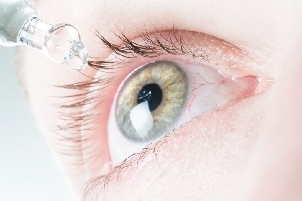 Das Auge ist von feinen Blutgefäßen durchzogen. Dass da mal eines platzt und für ein blutrotes Auge sorgt, lässt sich kaum vermeiden.