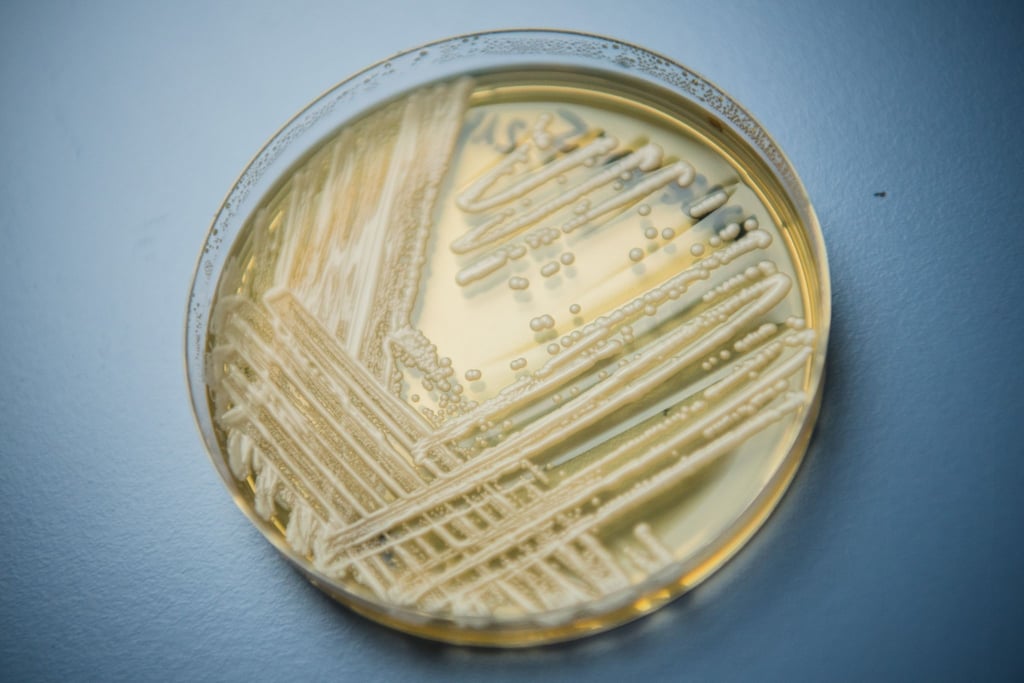 Der Hefepilz Candida auris in einer Petrischale. Die Weltgesundheitsorganisation (WHO) ist besorgt über 19 kranheitserregende Pilze, die nach Expertenansicht die öffentliche Gesundheit bedrohen.