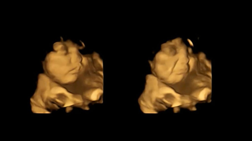 Bereits im Mutterleib reagieren Babys positiv oder negativ auf manche Lebensmittel, wie die Wissenschaftler der nordostenglischen Universität Durham herausfanden.