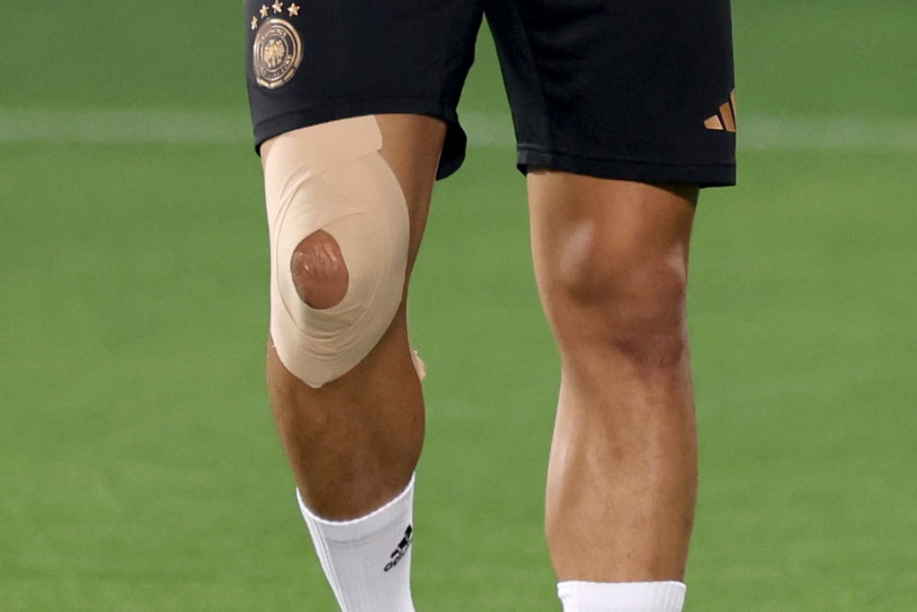 Das lädierte Knie von Nationalspieler Leroy Sané.