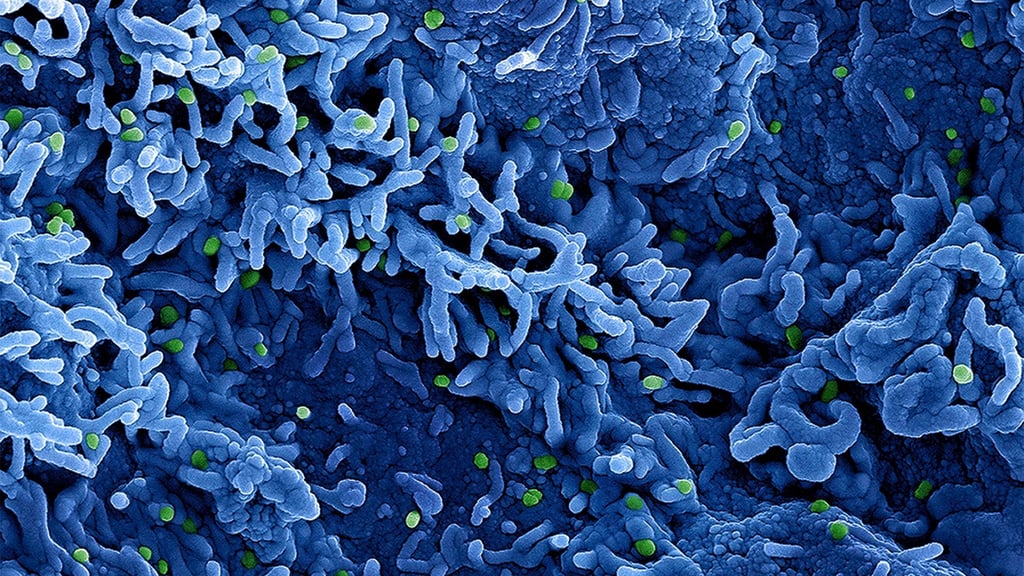 Die Weltgesundheitsorganisation (WHO) benutzt ab sofort statt Monkeypox die Bezeichnung Mpox.