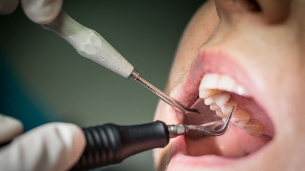 Die Kosten für eine Zahnreinigung muss man meist nicht alleine tragen. Wer sich den Zuschuss holen möchte, sollte aber prüfen, ob die Krankenkasse mit Selektivverträgen arbeitet.