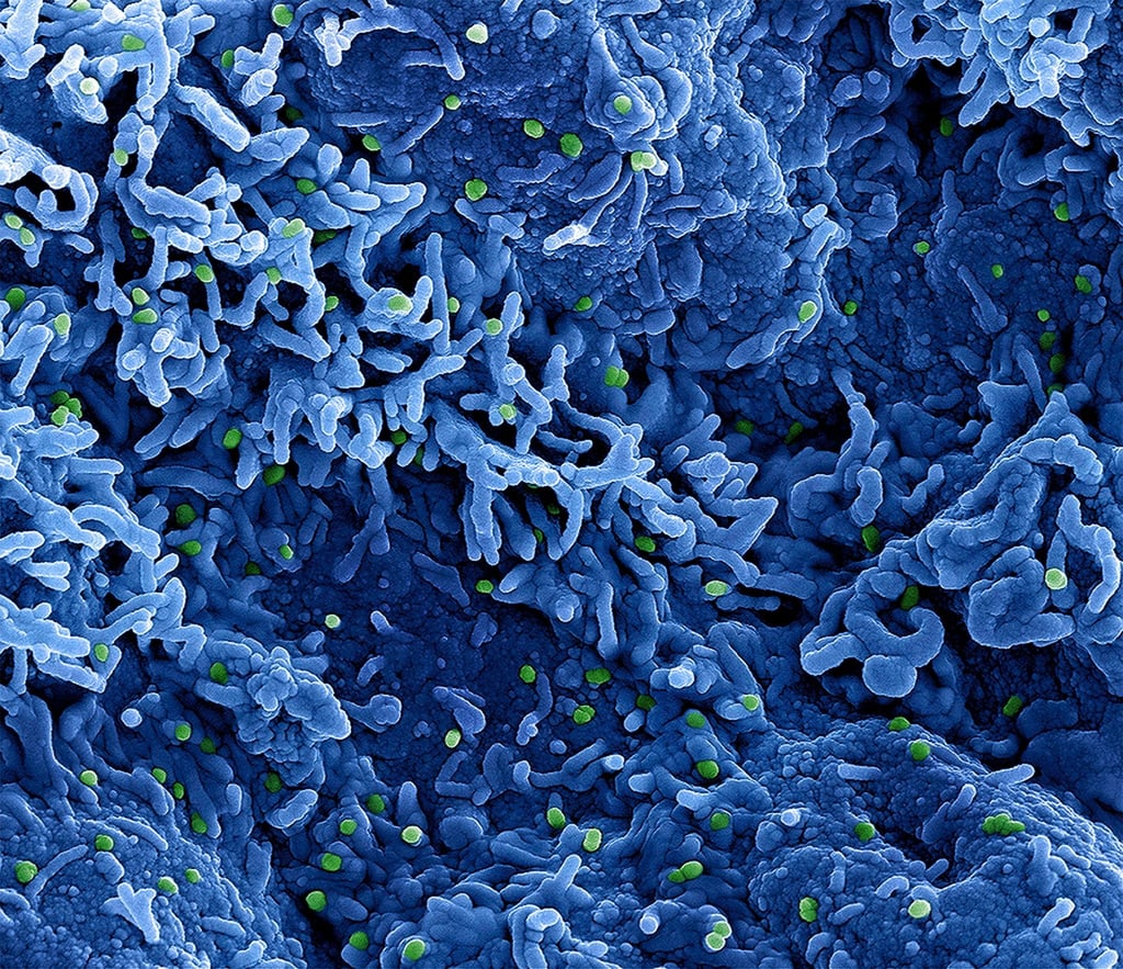 Die Weltgesundheitsorganisation (WHO) benutzt ab sofort statt Monkeypox die Bezeichnung Mpox.