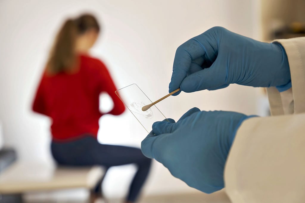 Gebärmutterhalskrebs-Früherkennung: Mit dem Pap-Test können Krebszellen oder Vorstufen von Krebszellen frühzeitig erkannt werden. Dazu wird ein Zellabstrich von Muttermund und Gebärmutterhals unter dem Mikroskop untersucht.