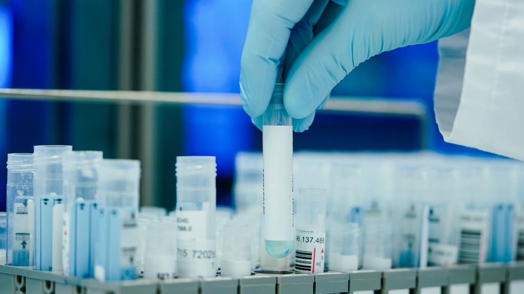 Die Coronavirus-Sublinie XBB.1.5 dürfte aus Sicht der EU-Gesundheitsbehörde nicht zu schwereren Krankheitsverläufen führen.