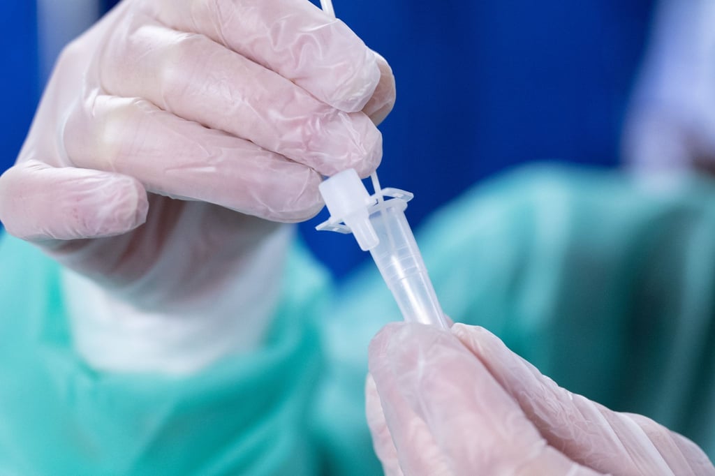 Omikron-Sublinie XBB.1.5 breitet sich in Deutschland weiter aus. Laut RKI ist sie nun die am zweithäufigsten in der Stichprobe nachgewiesene Variante.