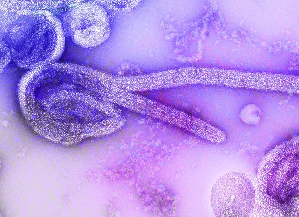 Eine elektronenmikroskopische Aufnahme des Marburgvirus.