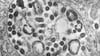 Die Transmissionselektronenmikroskopie (TEM) einer Gewebeprobe zeigt das Vorhandensein zahlreicher Marburg-Viruspartikel.
