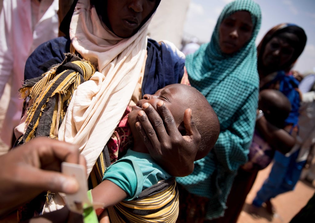 In einer medizinischen Einrichtung in der von Hunger geplagten Region Somali in Äthiopien wird der Armumfang eines Babys gemessen.
