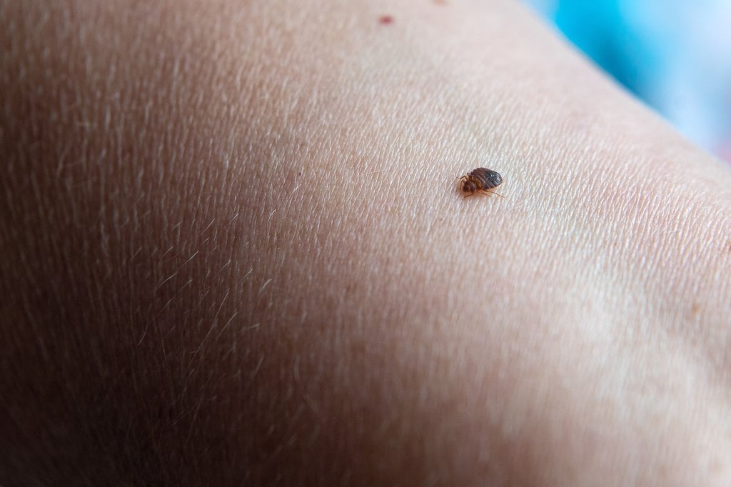 Bettwanzen saugen Blut und sondern dabei ein gerinnungshemmendes Sekret ab, das starken Juckreiz auslöst.
