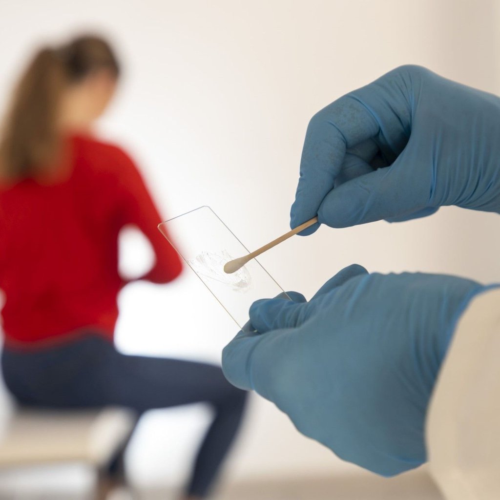 Gebärmutterhalskrebs-Früherkennung: Mit dem Pap-Test können Krebszellen oder Vorstufen von Krebszellen frühzeitig erkannt werden. Dazu wird ein Zellabstrich von Muttermund und Gebärmutterhals unter dem Mikroskop untersucht.