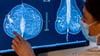 Mammografie in einer Klinik in Berlin. Frauen sind nicht nur von Brustkrebs betroffen, sondern häufig auch von Gebärmutter-, Lungen- und Darmkrebs.