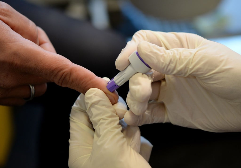 Beim HIV-Test (Symbolfoto)
