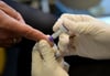 Beim  HIV-Test (Symbolfoto)