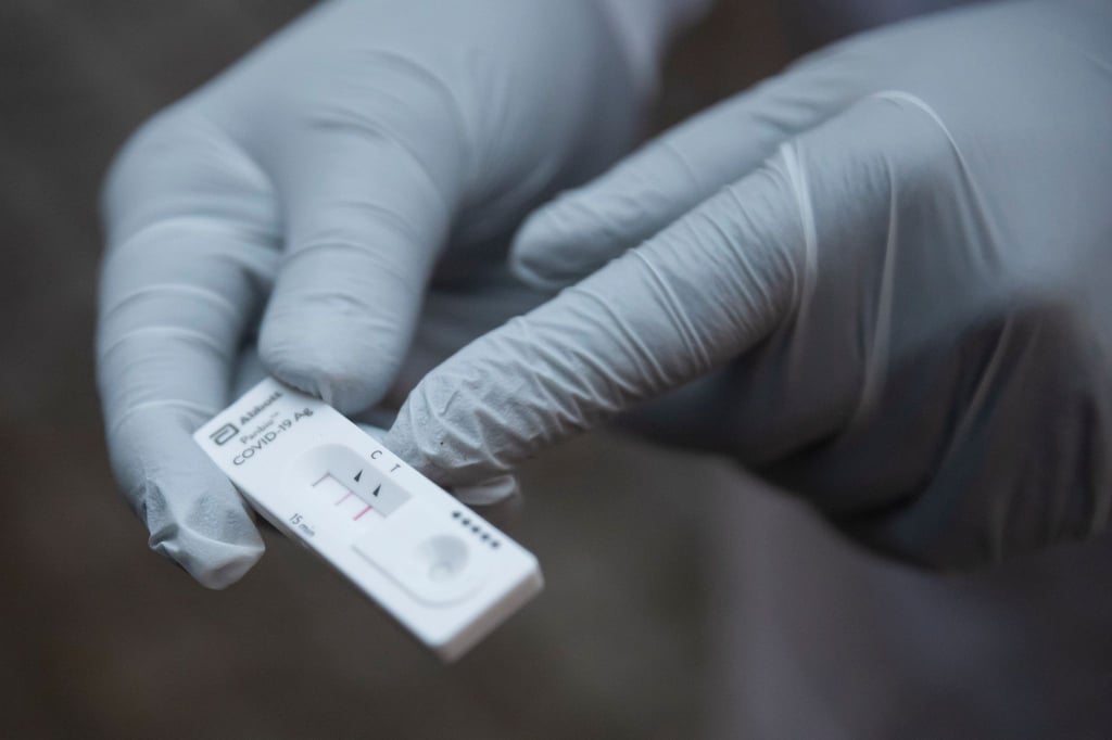 Ein Medizinischer Mitarbeiter hält einen Corona-Schnelltest in der Hand.