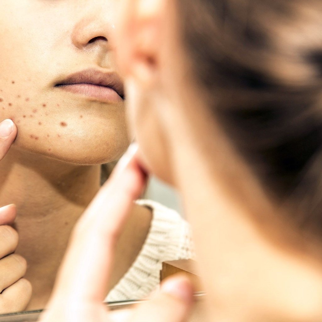 Bei Hautproblemen können Versicherte der AOK Sachsen-Anhalt ab sofort mit einem Online-Hautcheck über onlinedoctor.de innerhalb von 48 Stunden kostenfrei eine Diagnose und Therapieempfehlung erhalten