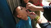 Ein Kind erhält eine Dosis Anti-Polio-Impfstoff: Polio ist eine ansteckende Infektionskrankheit, die vor allem bei Kleinkindern dauerhafte Lähmungen hervorrufen und zum Tod führen kann.