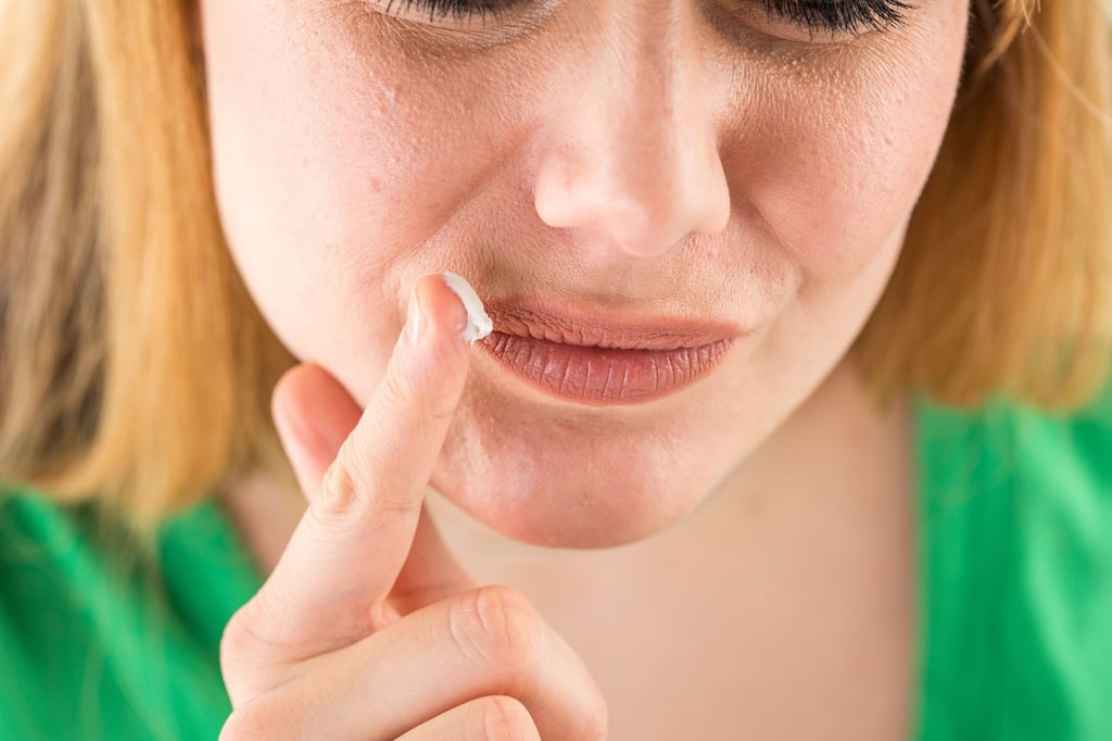 Gegen die trockene Haut und damit gegen Rhagaden: Gerade im Winter ist eine gute Haut- und Lippenpflege wichtig. (zu dpa: „Autsch! Was hilft bei eingerissenen Mundwinkeln?“)