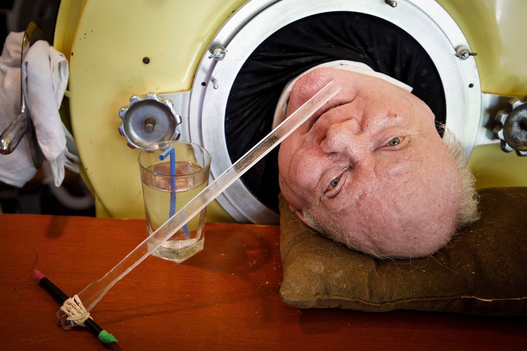 Paul Alexander ist im Alter von 78 Jahren gestorben.