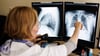 Eine Radiologin analysiert in ihrem Büro die Röntgenbilder der Lunge einer aus der Ukraine geflüchteten Person.