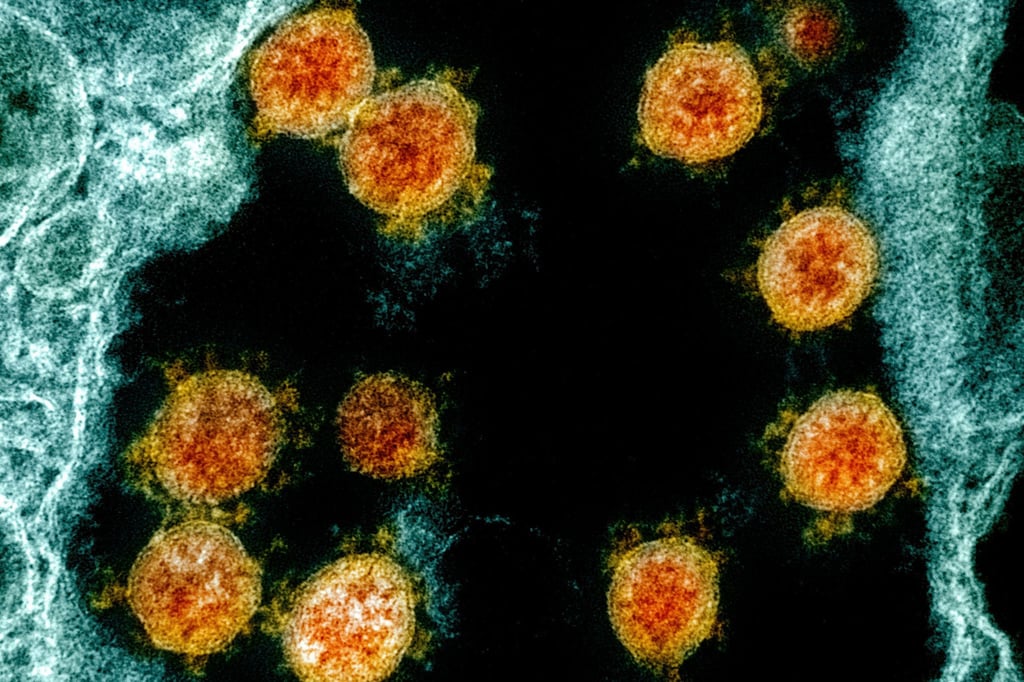 Partikel des Coronavirus SARS-CoV-2 wurden für eine elektronenmikroskopische Aufnahme farblich bearbeitet.