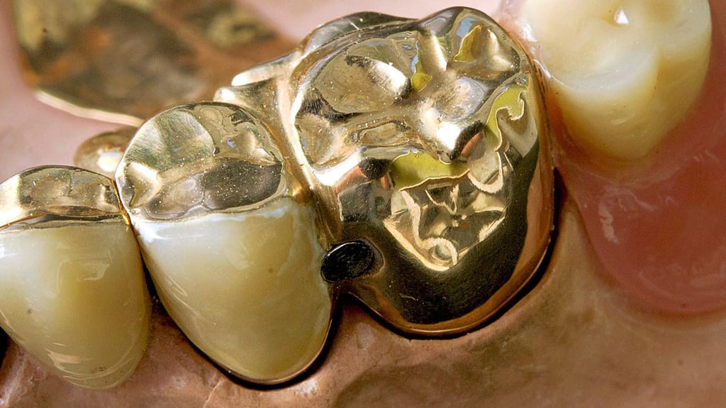 Eine Zahnprothese, die zum Teil aus Gold besteht.