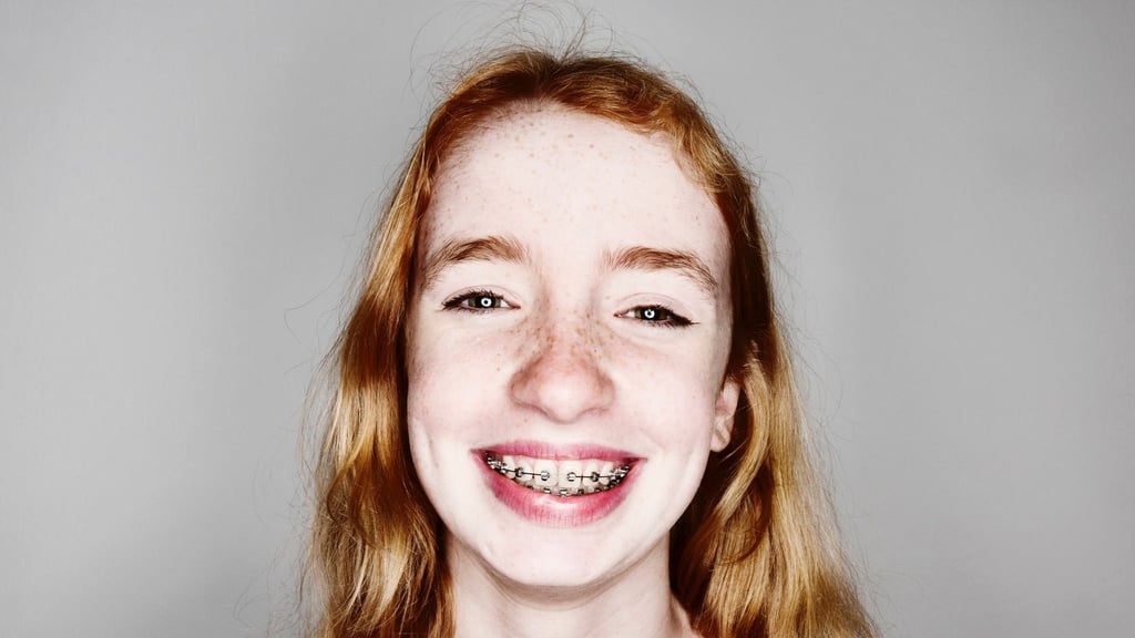 Zahnspange ist nicht gleich Zahnspange: Familien haben die Wahl zwischen der Kassen-Variante und einem Modell mit zahlreichen Extras.