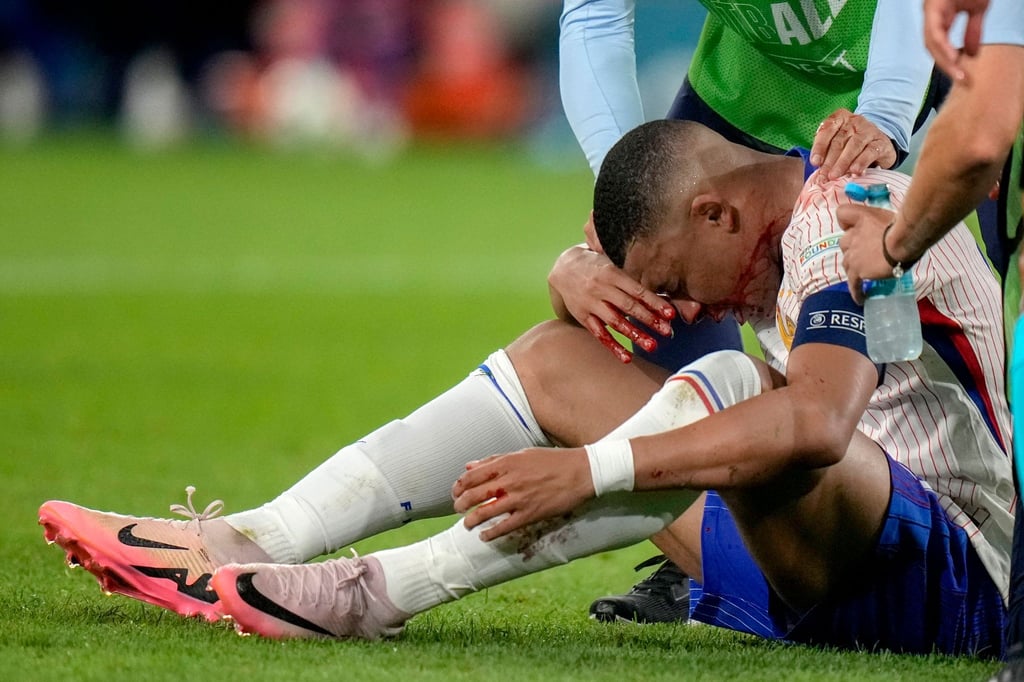 Mbappé zog sich die Verletzung kurz vor Schluss bei einem Zweikampf zu.