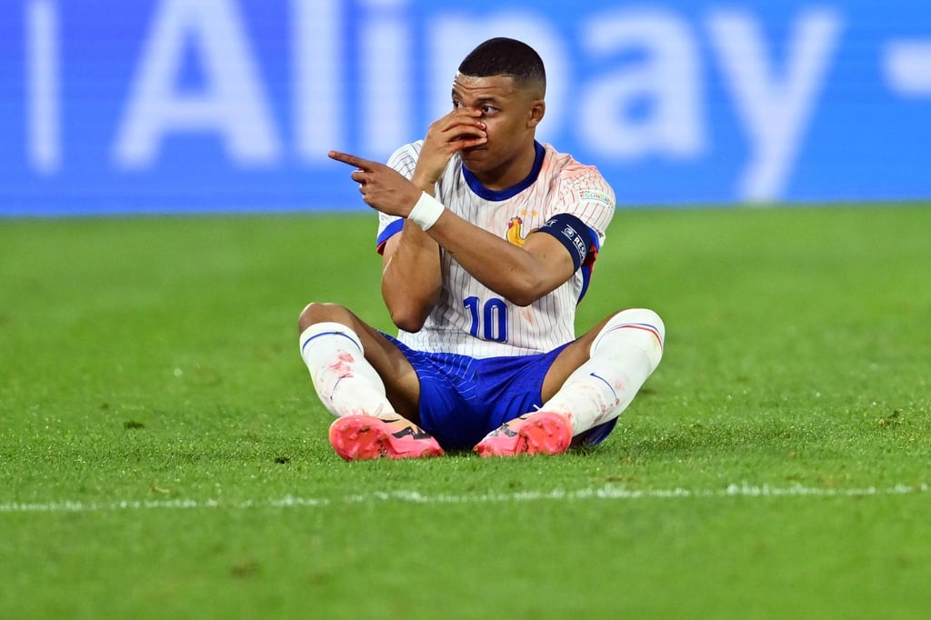 Diagnose Nasenbeinbruch: Frankreichs Kylian Mbappé sitzt beim Spiel gegen Österreich auf dem Rasen und hält seine verletzte Nase.