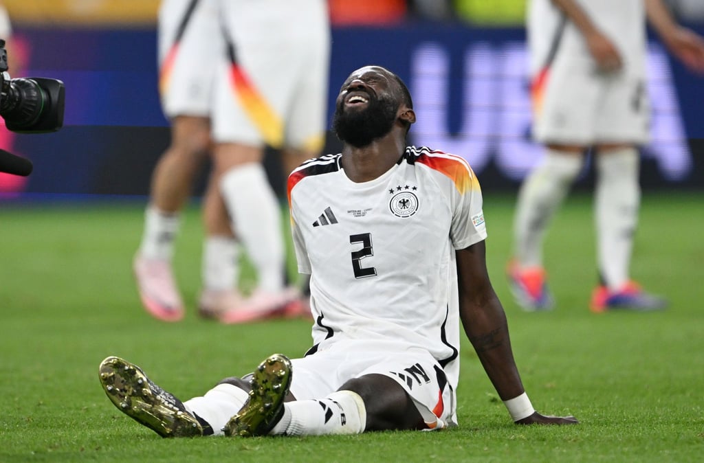 Antonio Rüdiger hat sich in der Partie gegen die Schweiz am Oberschenkel verletzt.