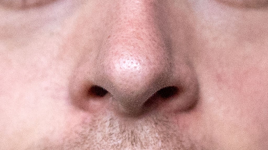 Je älter man wird, desto schneller wachsen die Nasenhaare.