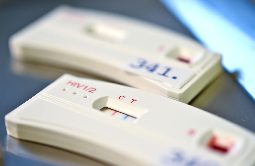 Ein Schnelltest hilft bein der Erkennung einer HIV-Infektion. (Aschivbild)