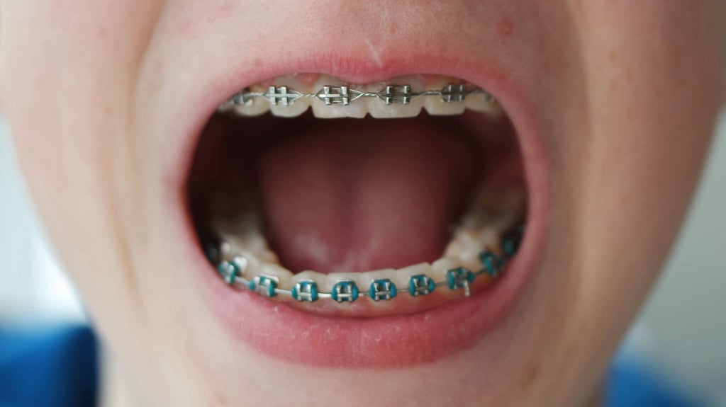 Etwa jedes zweite Kind in Sachsen-Anhalt trägt eine Zahnspange.